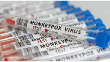 Quelles sont les règles d'hygiène à adopter pour limiter la propagation du virus mpox Quelles sont les règles d'hygiène à adopter pour limiter la propagation du virus mpox